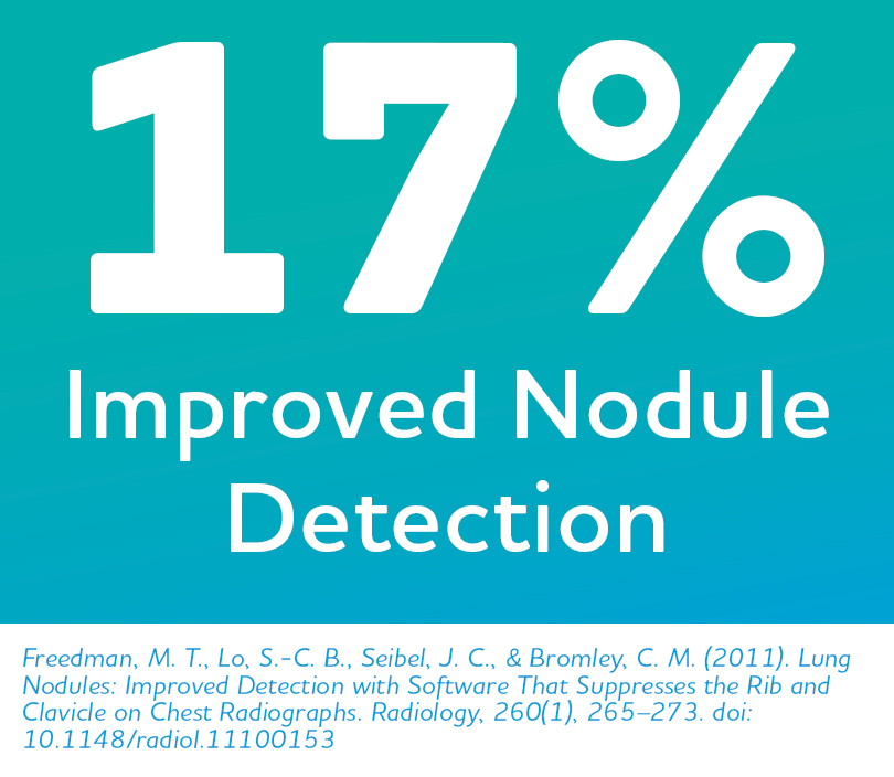Graphic: 17% improved nodule detection