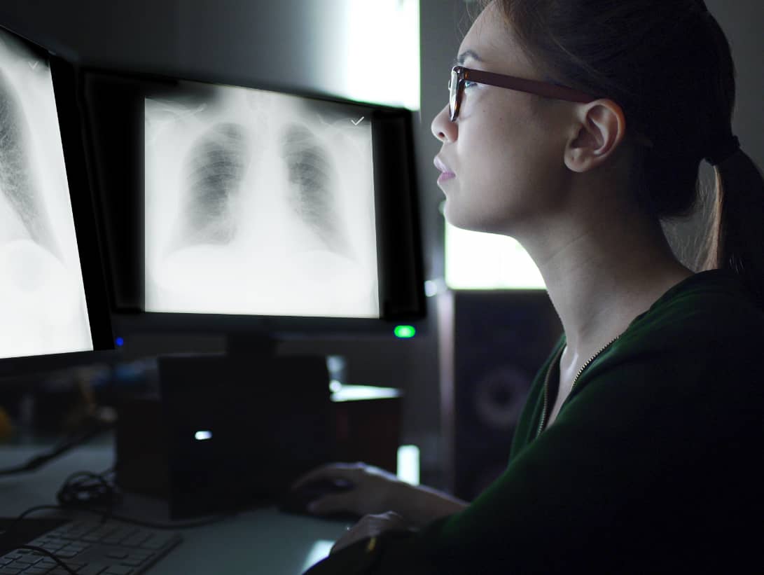 Woman radiologist viewing lung Xrays on video monitor