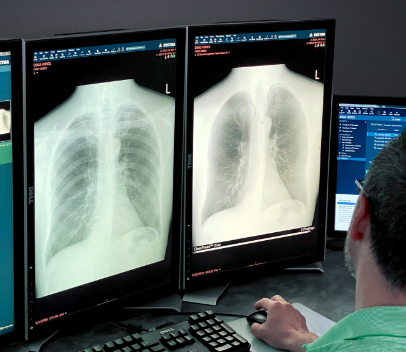 Radiologist studies ClearRead Xray images on computer screen