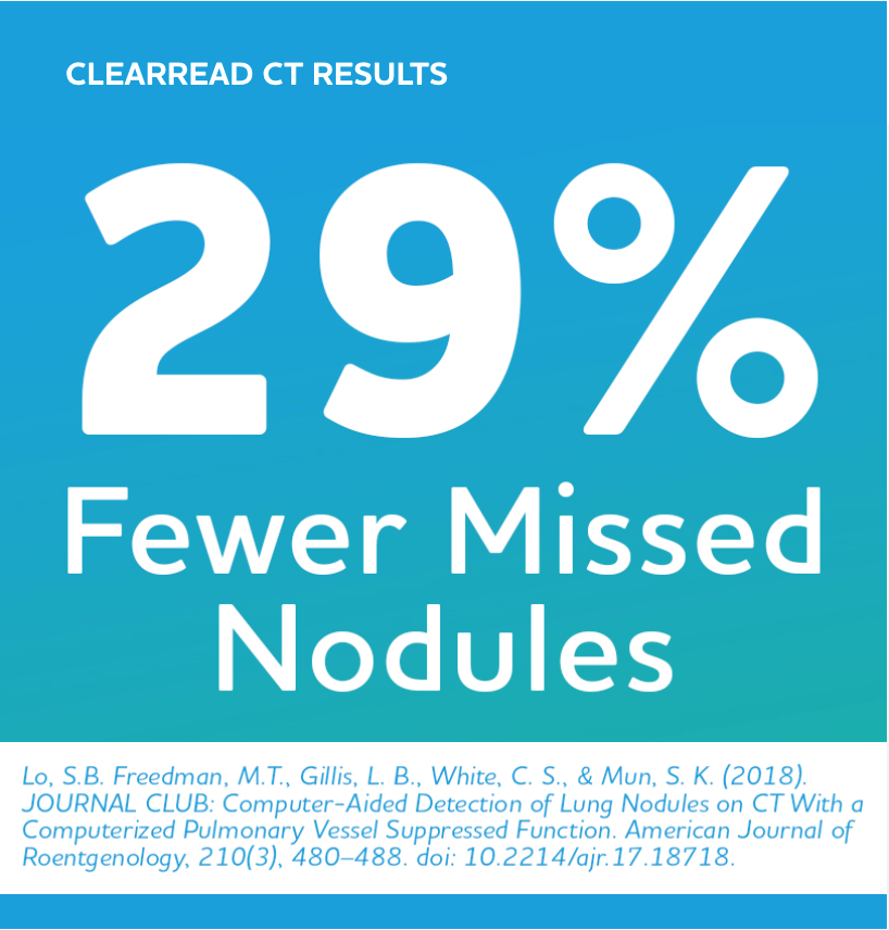 Graphic: 29% fewer missed nodules
