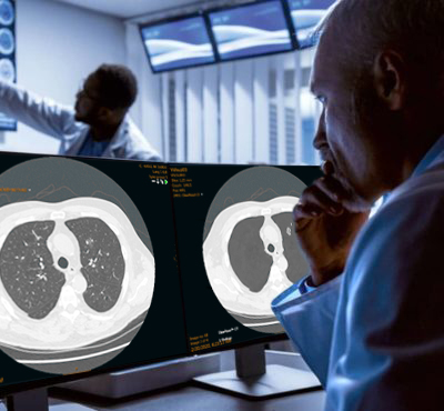 Radiologist studies ClearRead CT images on computer