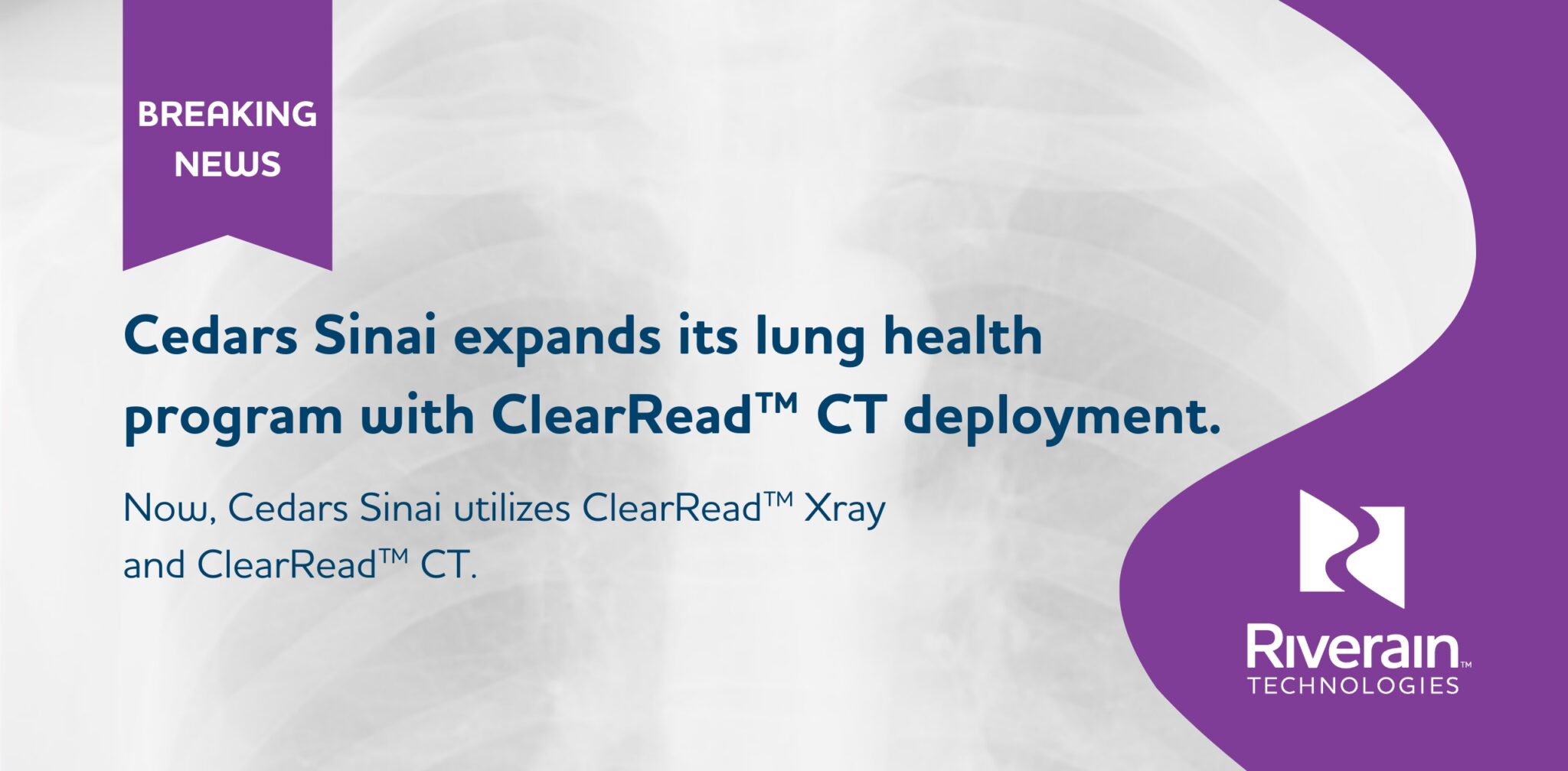Riverain’s ClearRead™ CT With Clear Visual Intelligence™ Now Deployed