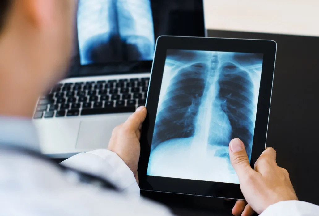 Technician holding ipad showing lung Xray