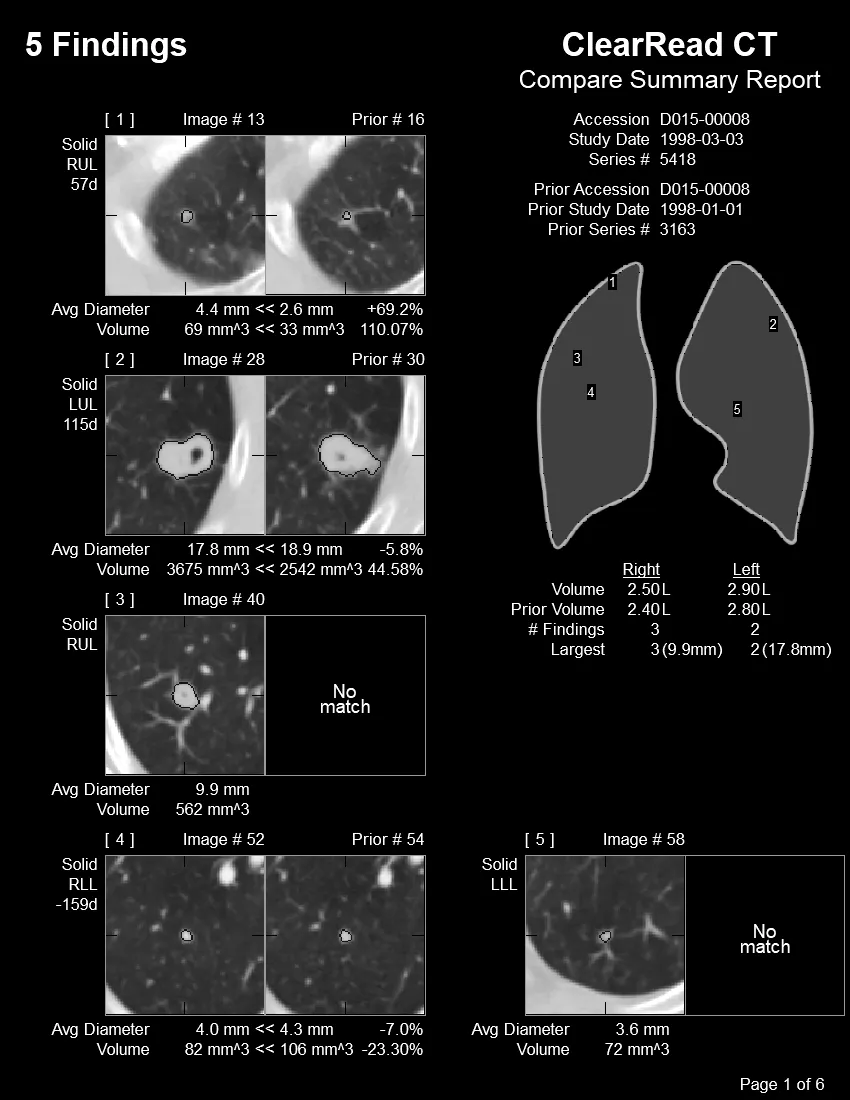 Riverain CT scan - several images