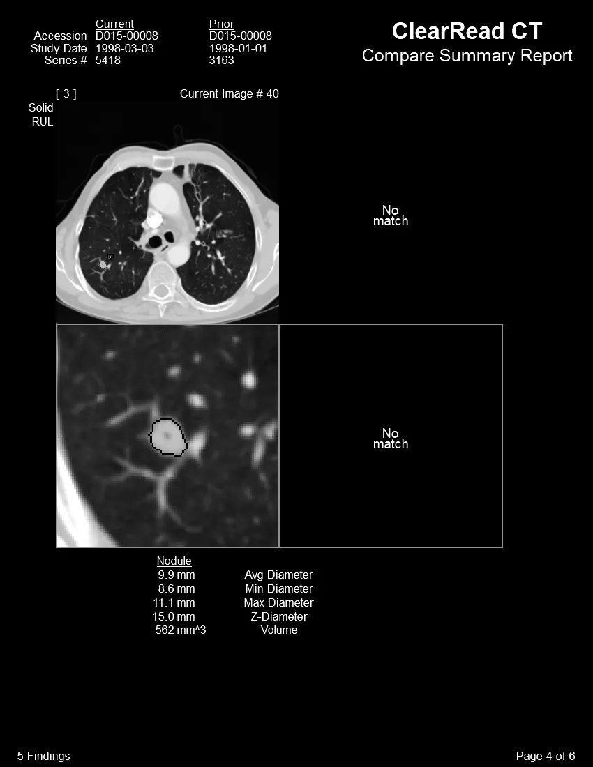 Riverain CT scan - several images