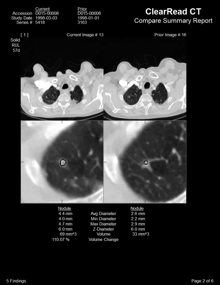 Riverain CT scan - several images