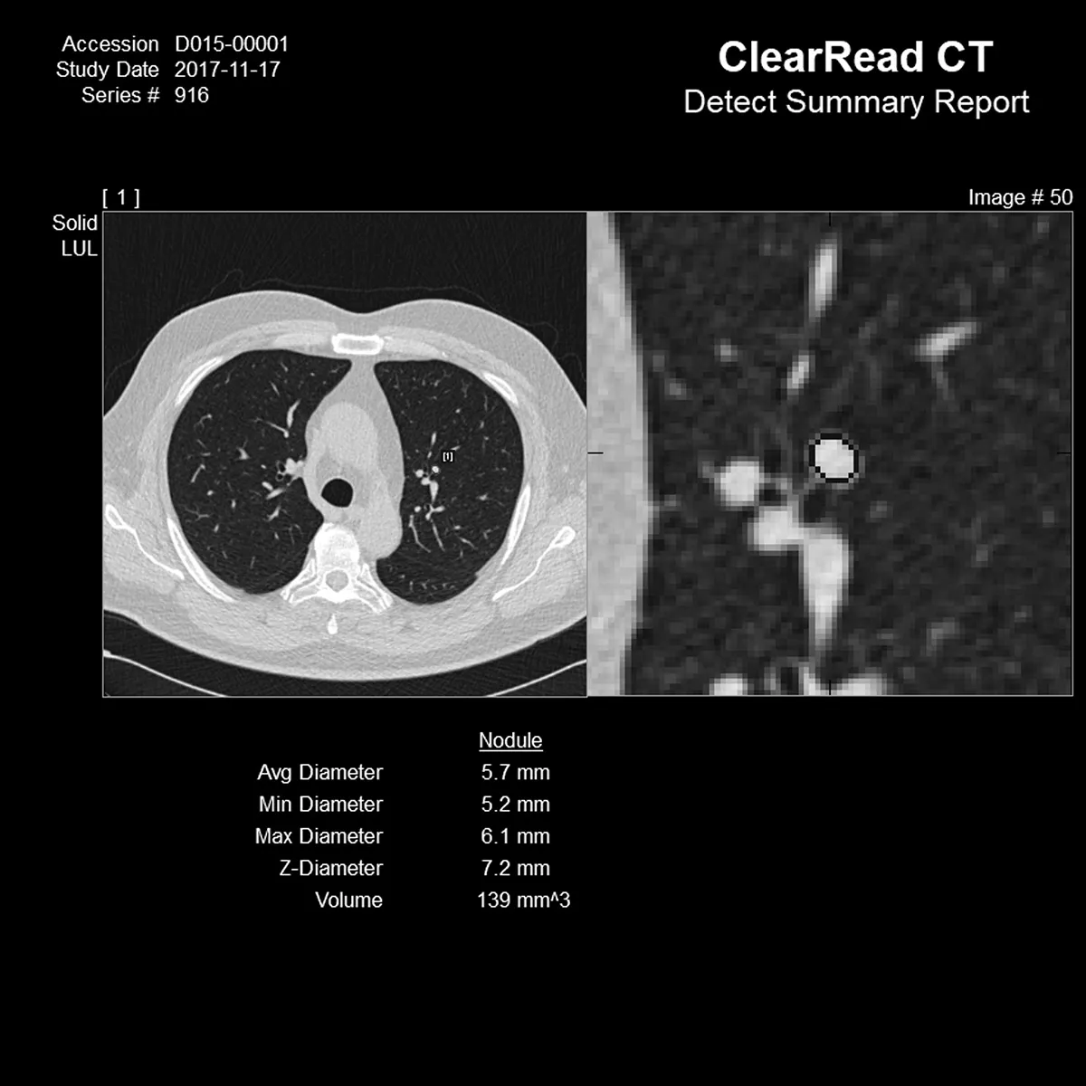 Long shot and close up of CT scan