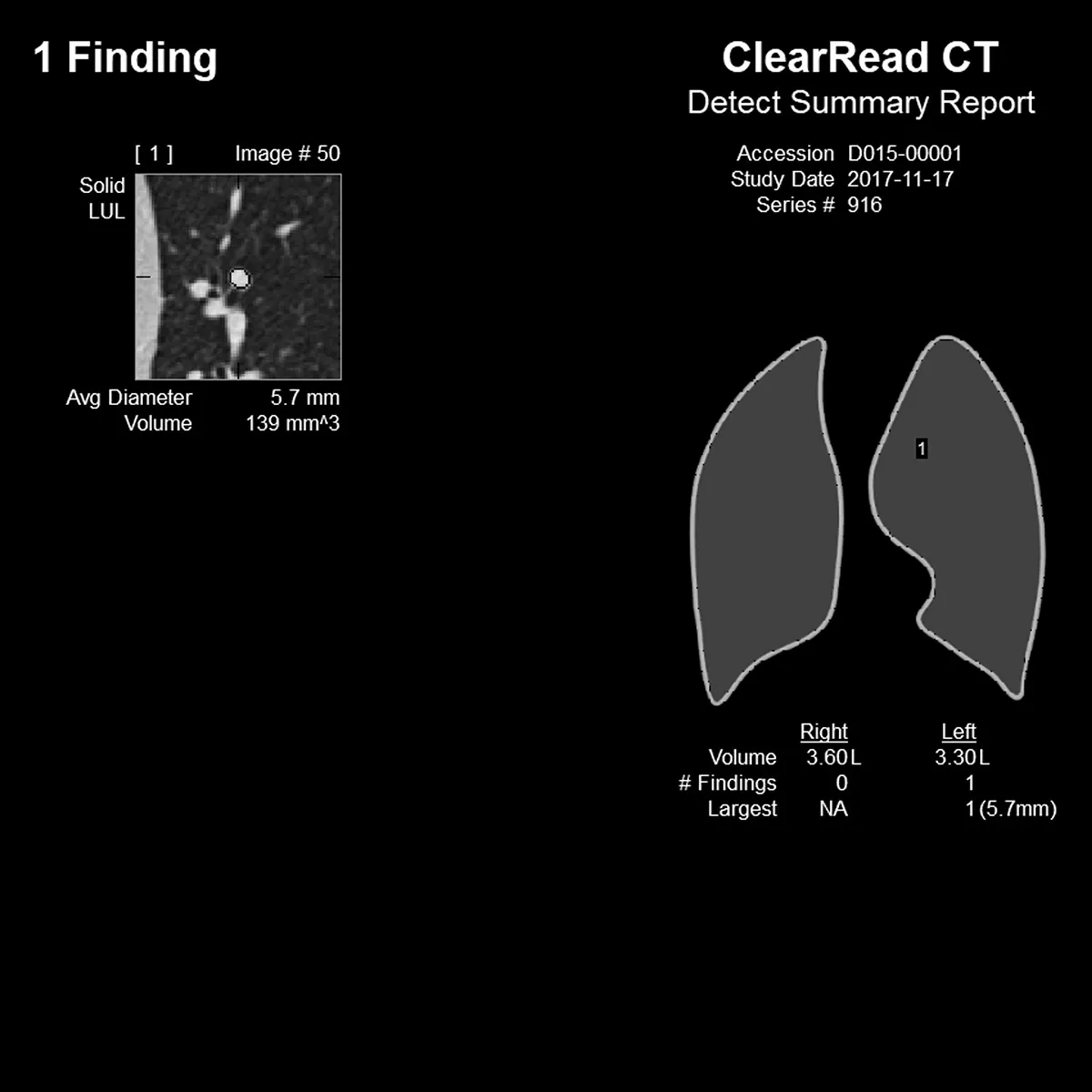 Two images from a Riverain CT scan