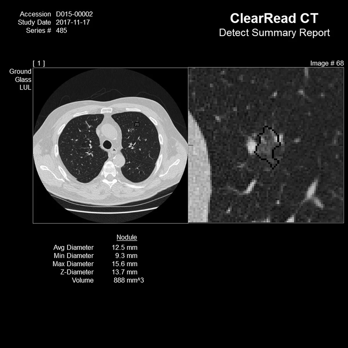 Long shot and close up of CT scan