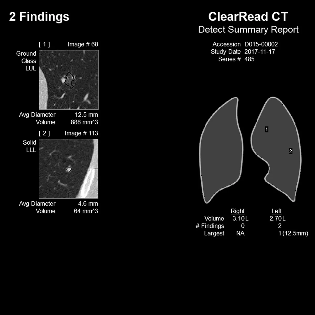 Riverain CT scan - several images