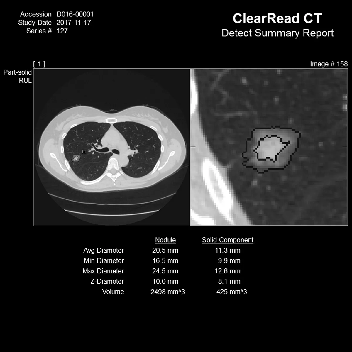 Long shot and close up of CT scan