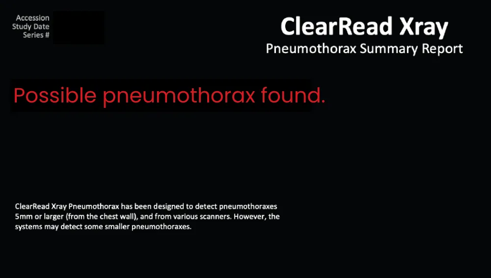 ClearRead Xray Pneumothorax notification