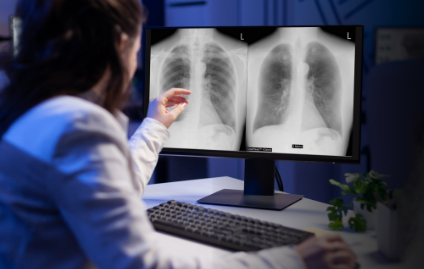 Physician examining multiple chest radiographs on a viewing station, representing the clinical evidence supporting Riverain Technologies AI diagnostic tools.