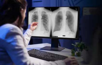 Clinical evidence resource card showing a radiologist examining chest imaging studies, providing access to peer-reviewed research supporting Riverain Technologies ClearRead diagnostic tools.