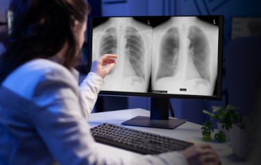 Clinical evidence widget card showing a radiologist analyzing chest radiographs on screen, representing Riverain Technologies peer-reviewed research supporting ClearRead AI diagnostic tools.
