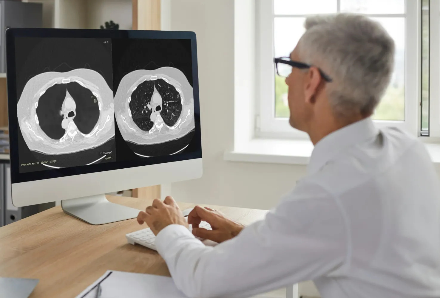 A senior radiologist discusses CT lung imagery with a colleague using dual diagnostic monitors, illustrating Riverain Technologies' series recommendations for optimal scan protocols.