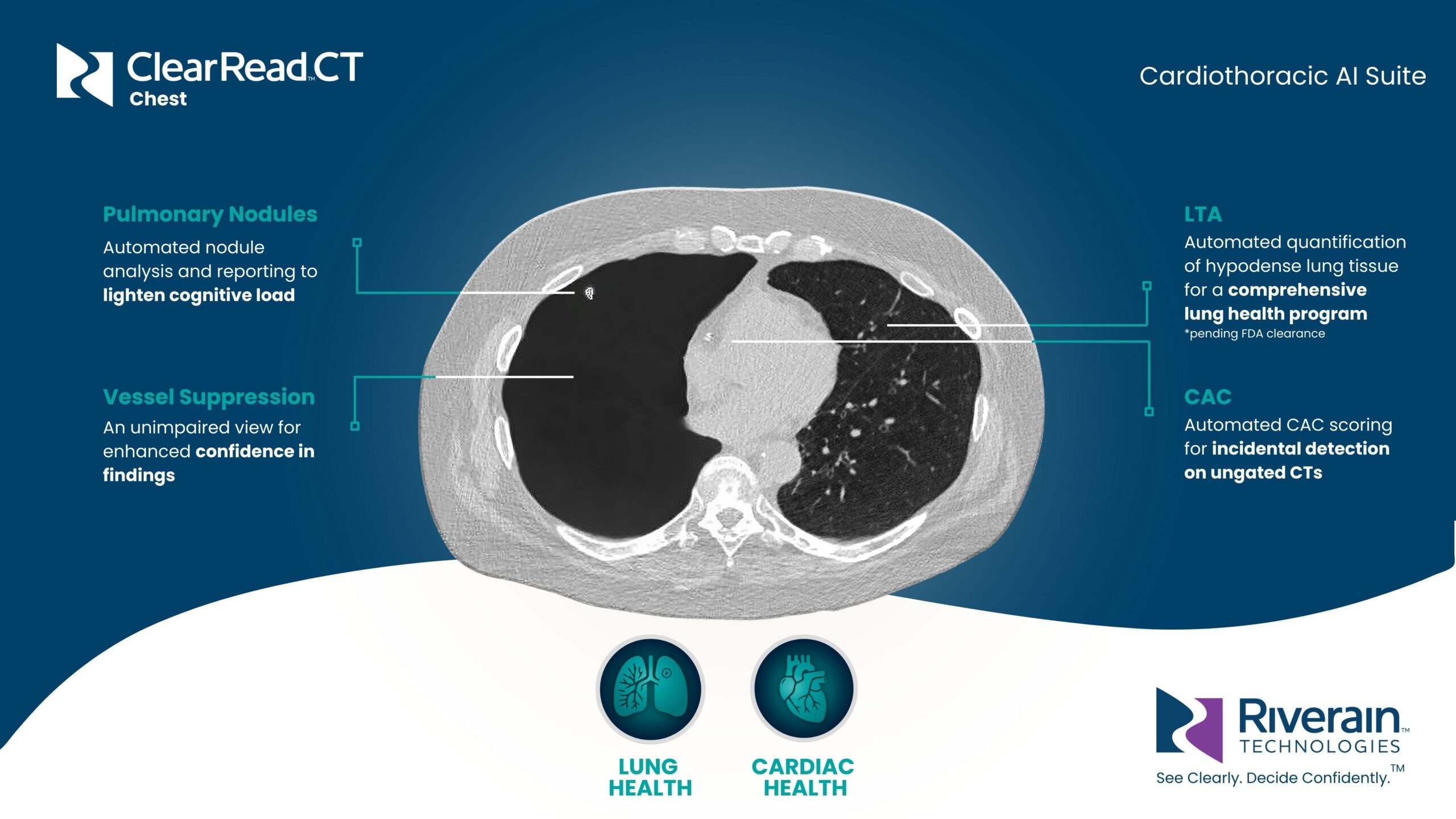ClearRead CT Cardiothoracic Health AI Suite - Riverain Tech